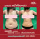 Slider image (9) DGB Plastic Surgery Clinic